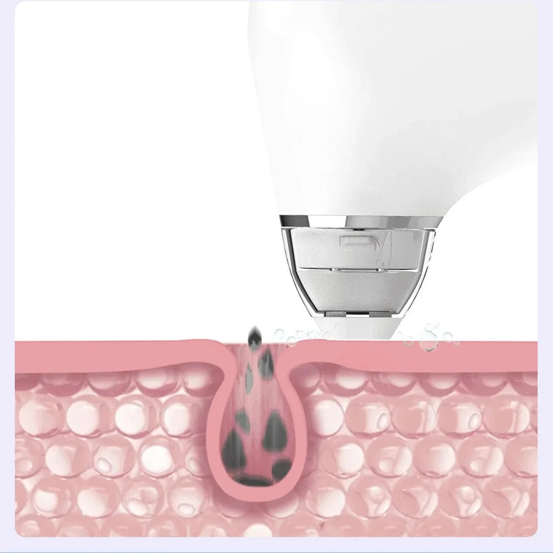 PoreVac Pro Clear Face System
